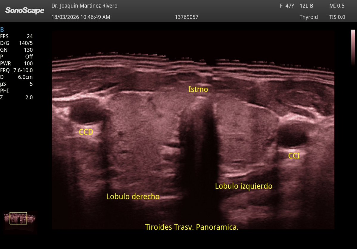 Joaquín Martínez tweet media