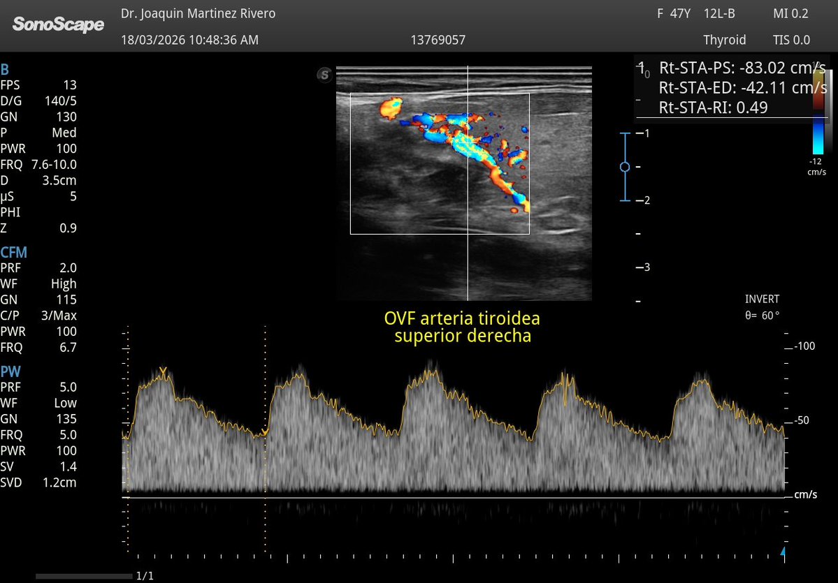 Joaquín Martínez tweet media