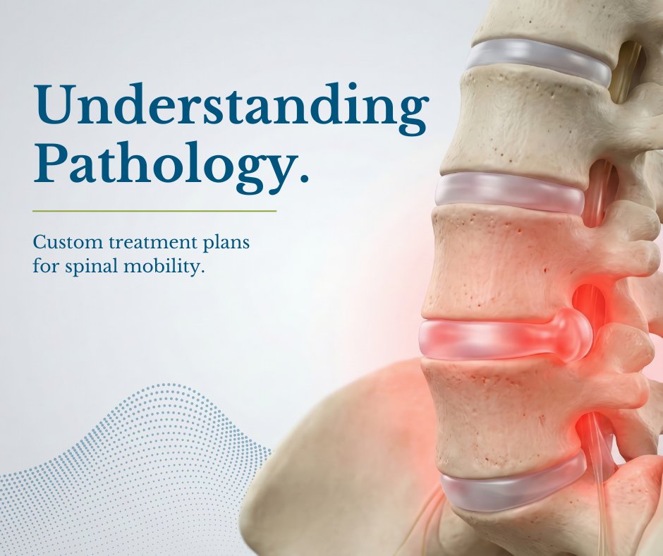 NeuroOfNJ's tweet photo. Spinal stenosis, the narrowing of the spinal canal, can cause persistent pressure on vital nerves, often presenting as radiating pain or weakness. Understanding the pathology of your back pain is the first step toward a plan to restore your mobility. https://t.co/OdZkIHKQkr https://t.co/LblIqW73Ul