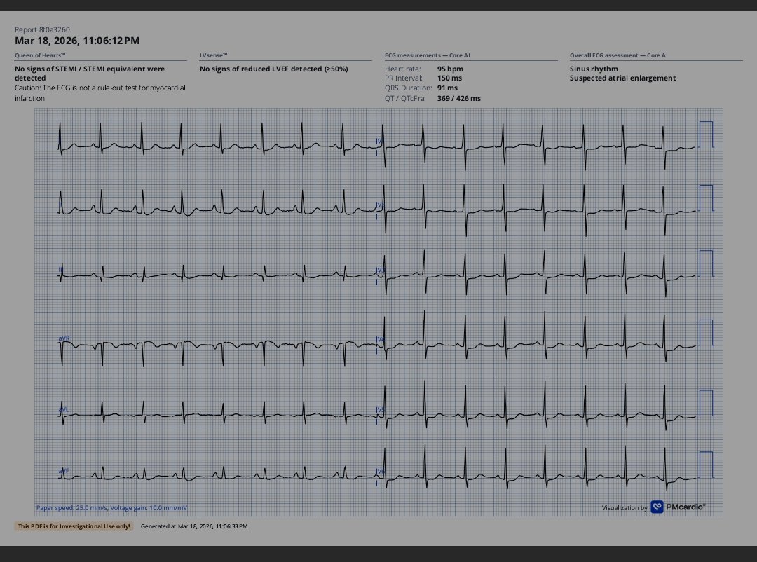 CardiologistDM's tweet photo. @rohan_khera For Raw ECG I compared interpretation with ECG gpt vs pm cardio. 

If you add a feature of post refinement ECG image as pm cardio is doing, it could be a good idea. https://t.co/FYGsohmAGj