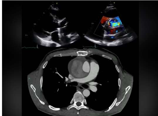 Echocardiography tweet media