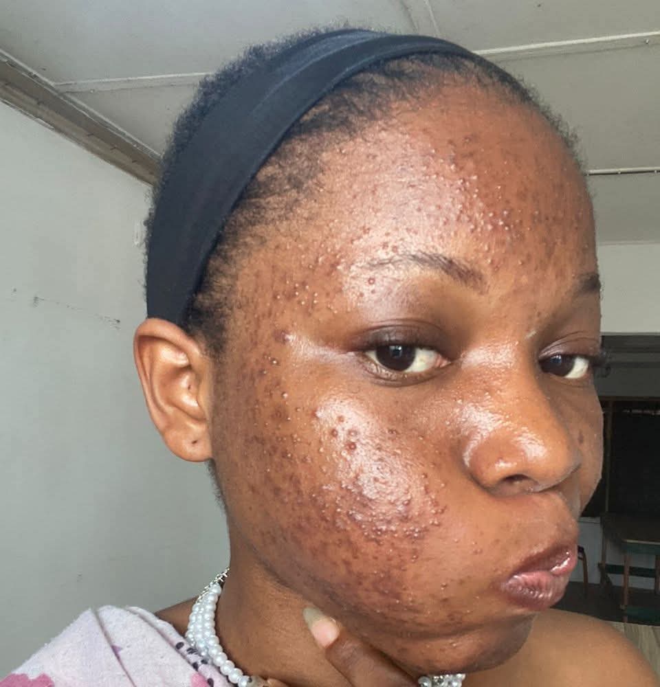 Sign of a Virgin ??😒