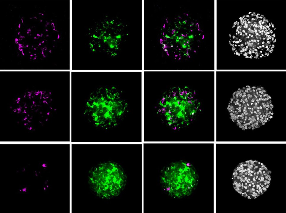 Pancreatic Cell News tweet media