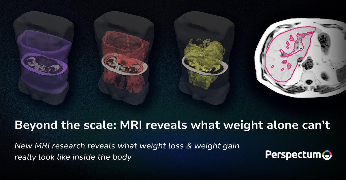 Perspectum tweet media