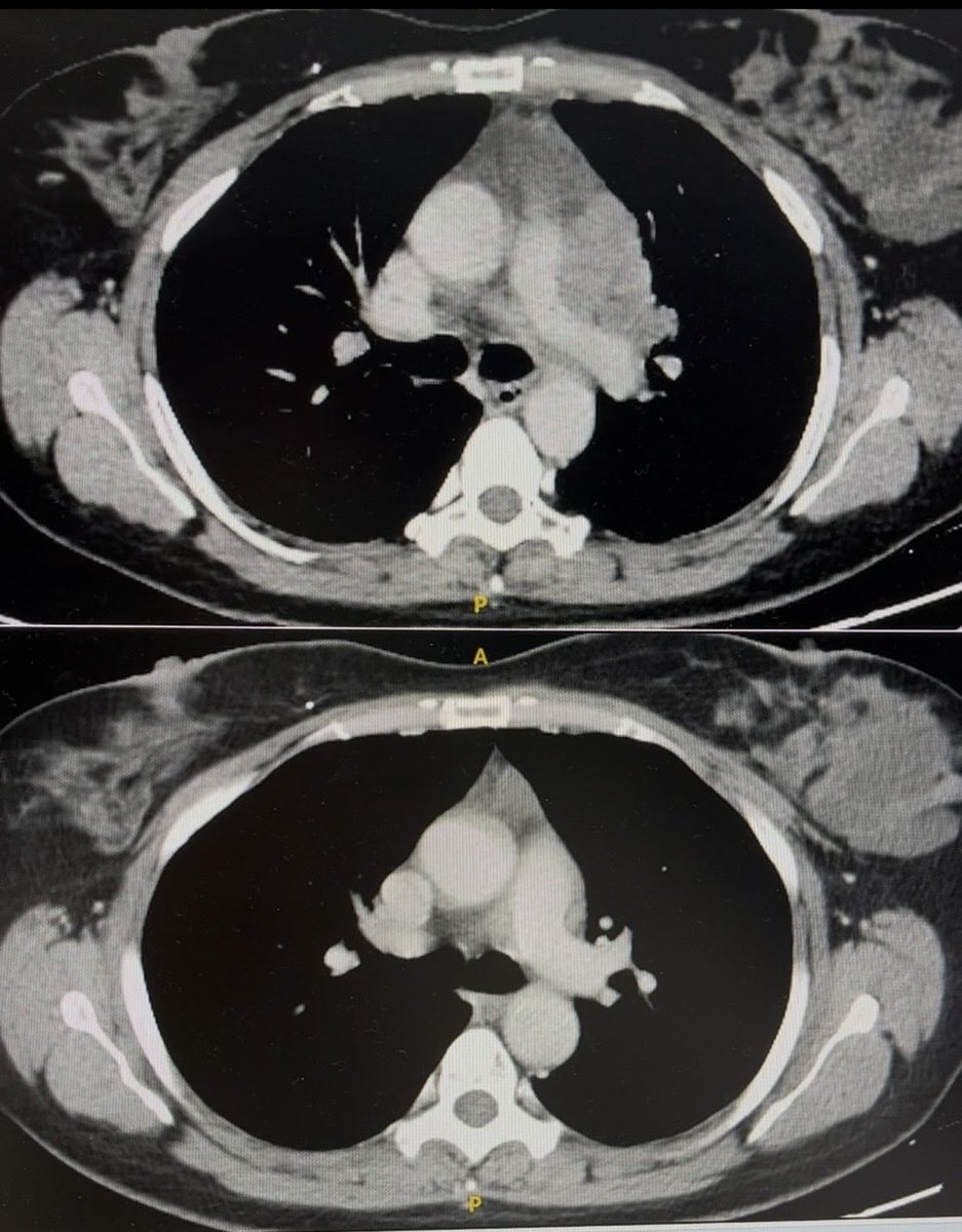 Baricorcho tweet media