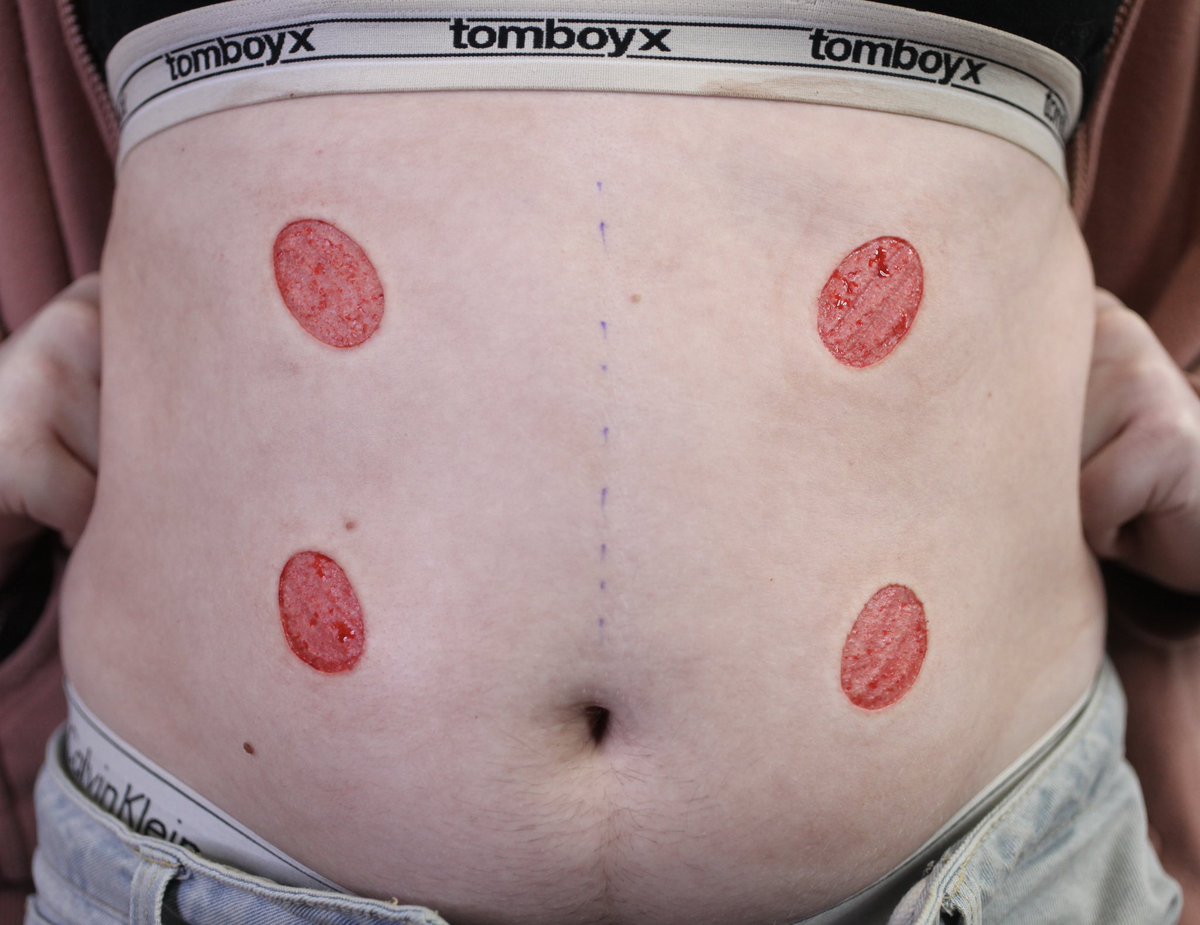 flesh connoisseur ⚧️ tweet media