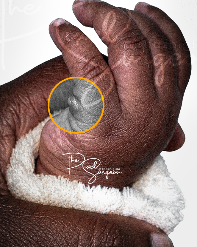 Simon Thazhigilla Simon tweet media