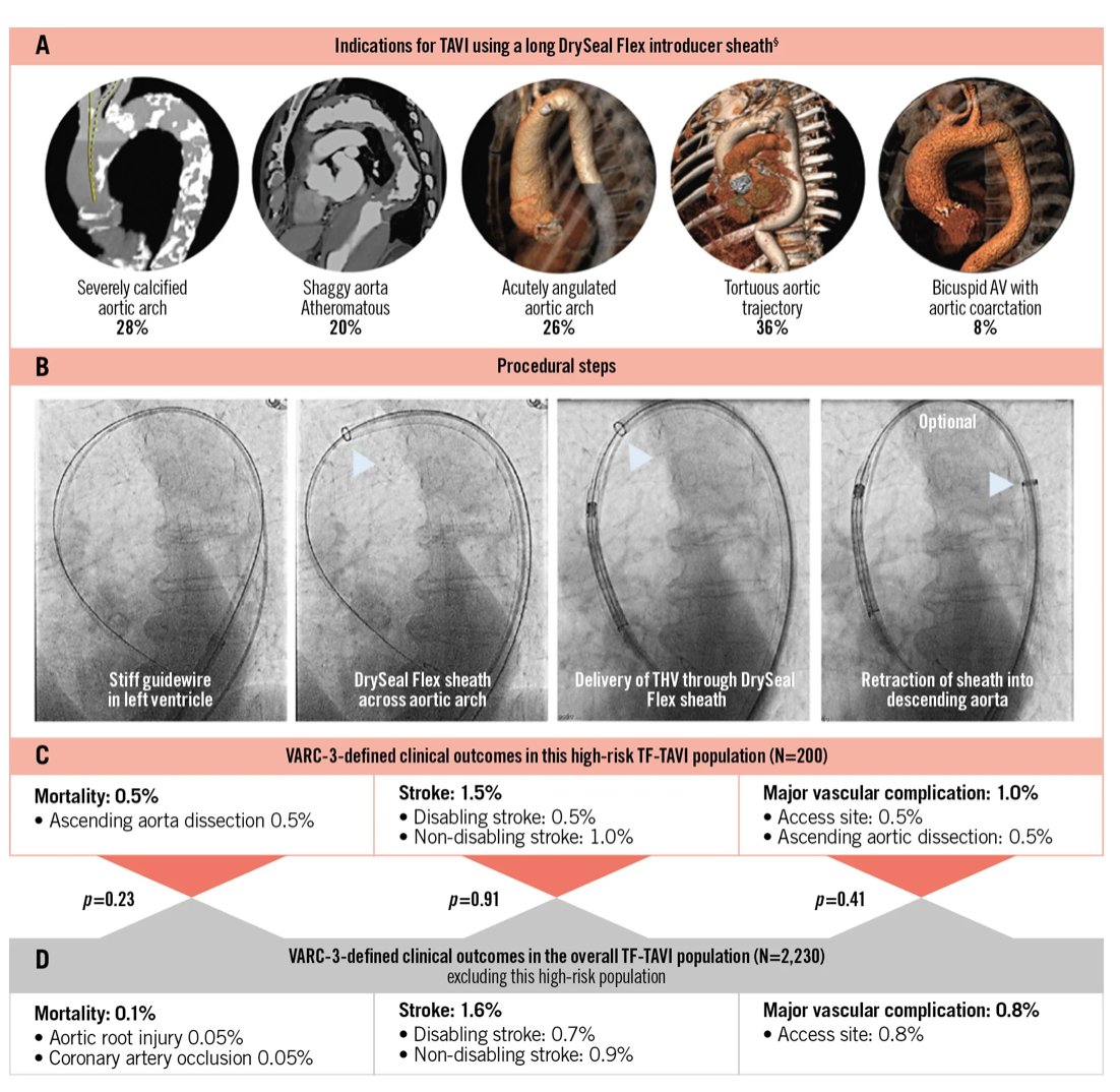 EuroIntervention tweet media