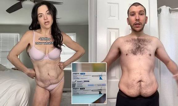 Notapiggynomore's tweet photo. 10. Loose skin

Triggering ik, also not a feature of people who are fat atm.

Nevertheless, I included it since if you are fat, you will have it. Only surgery can get rid of it. https://t.co/WuRRrVOqb9