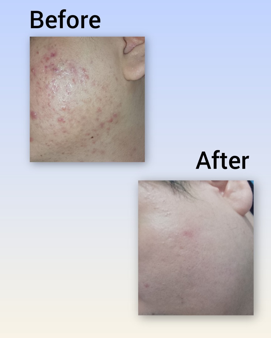 ✨OMBB | 🚫NO LINK tweet media