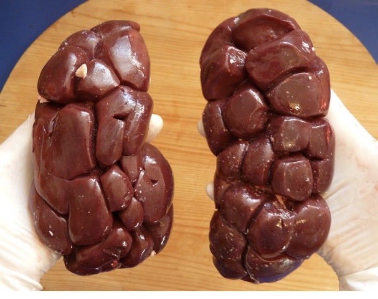 Corry Laura Sianturi tweet media