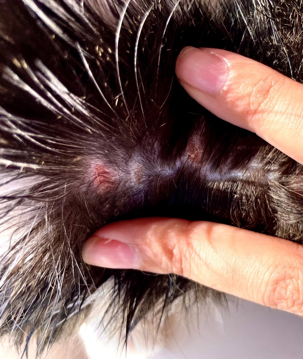 Mermaidkuromi's tweet photo. El vet le cambió a una pipeta mas bacán que dura 3 meses, porque tiene alergia a la picadura de pulga brígida. Se la puse y…le dió alergia a la pipeta 😩😮‍💨 

Foto de la zona de aplicación, otra de cómo se dejó la cabeza y unas con su Barbie que no suelta xd https://t.co/6ozTQMxfvP