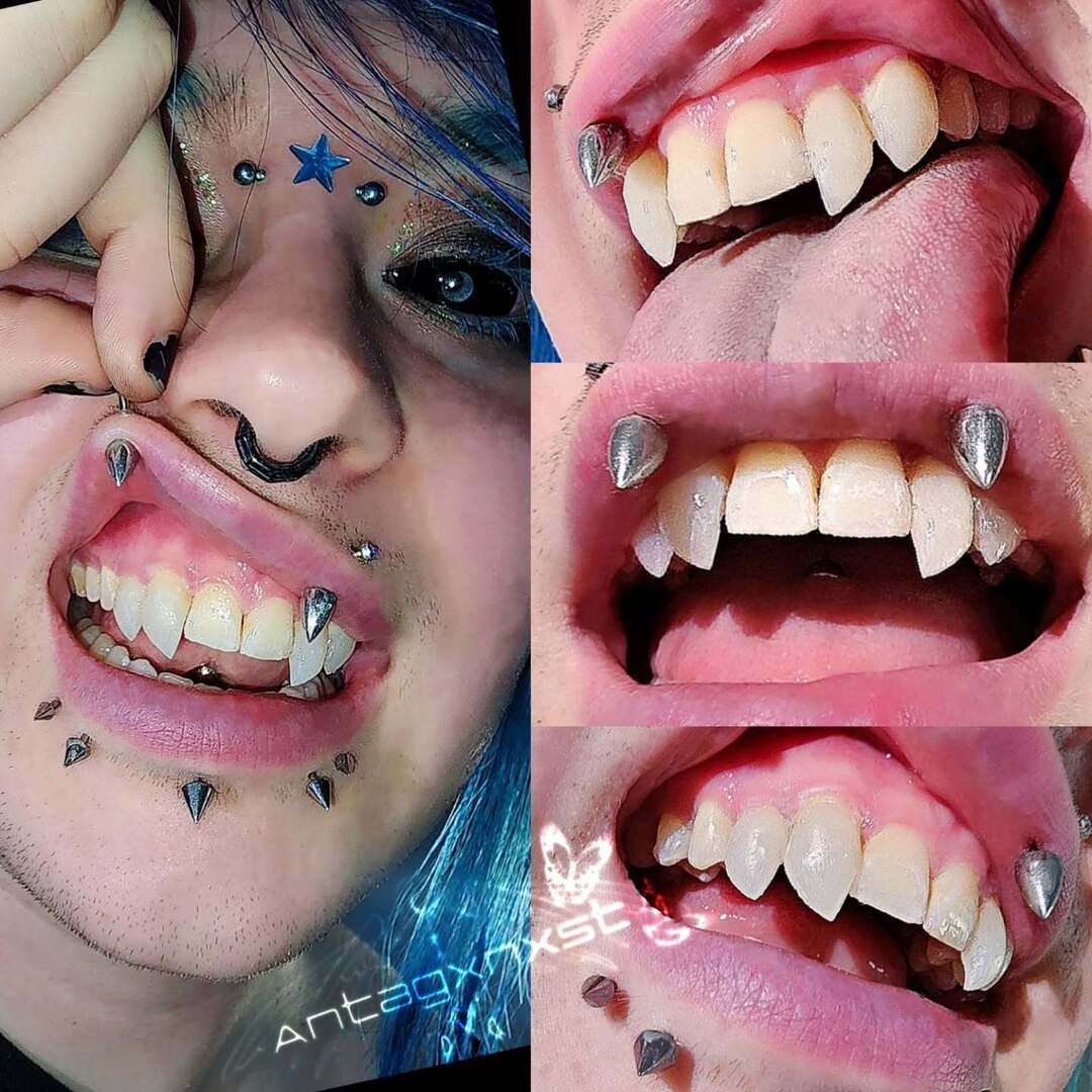 antagxnxst's tweet photo. Awesome client with a Carnivore II #permafang set 🦈
Orlando is booked out this upcoming May ~
But I still have availability in Atlanta and New Orleans!
Booking link in bio ✨️
•̩̩͙*˚⁺‧. •̩̩͙*˚⁺‧.˚ *•̩̩͙ ✩. •̩̩͙*˚⁺‧. •̩̩͙*˚⁺‧. ˚
#vampire #permafangs #toothm… https://t.co/hcAmGPv5ES
