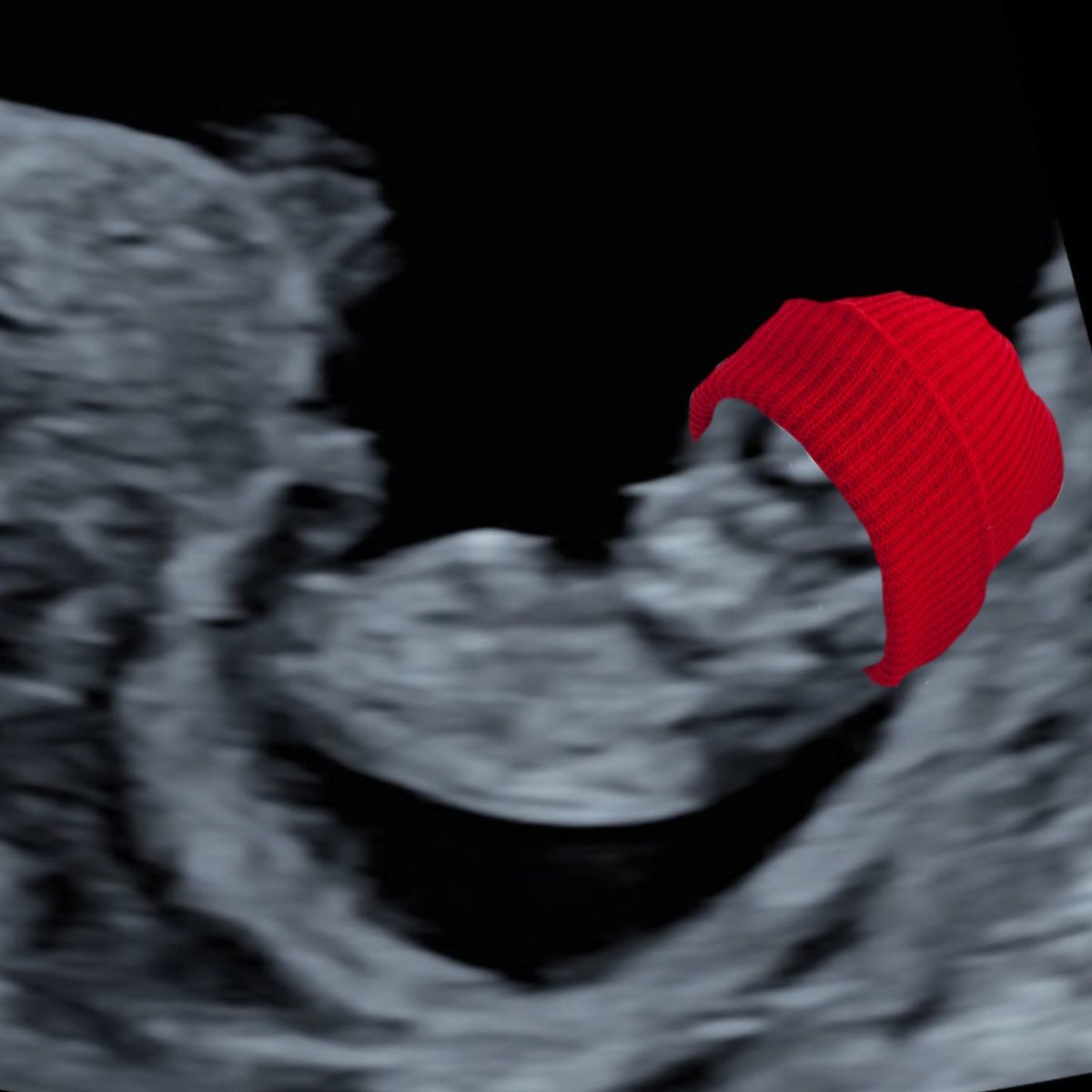 JSUN VOORHEEZ tweet media