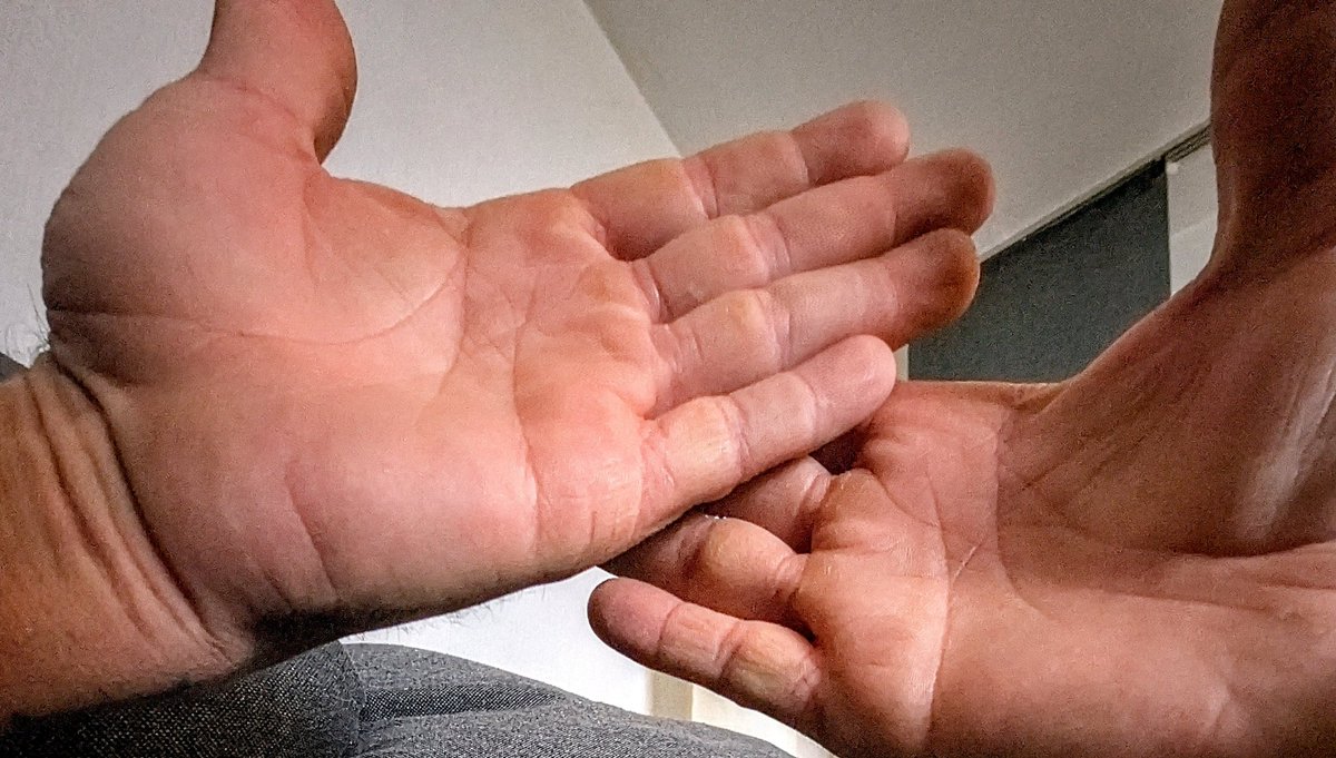 koehler_fr's tweet photo. @QTHESTORMM both hands https://t.co/mlKpTIy3R6