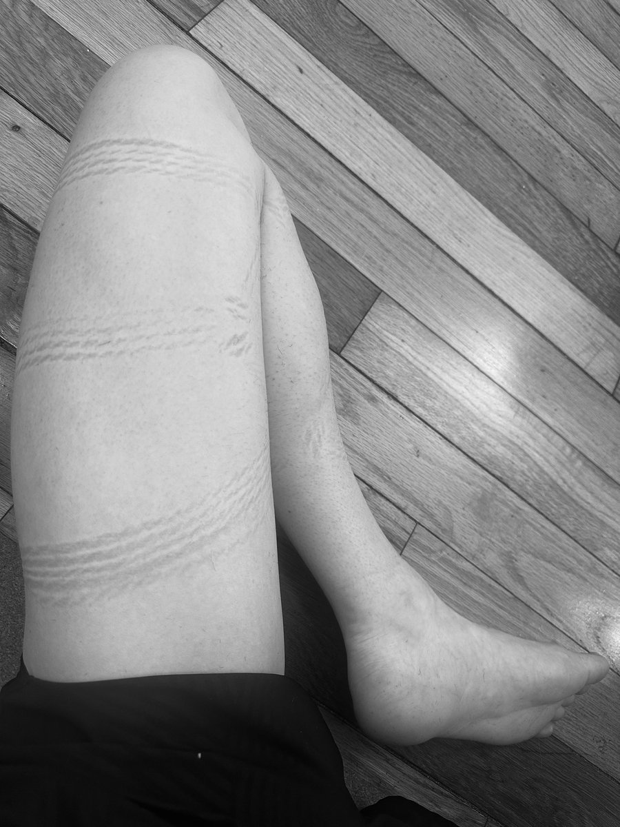 Hemlock 🔆 tweet media