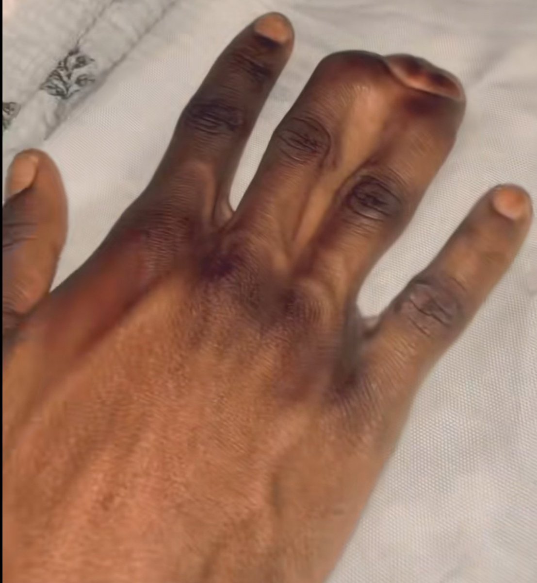 KP ONES tweet media