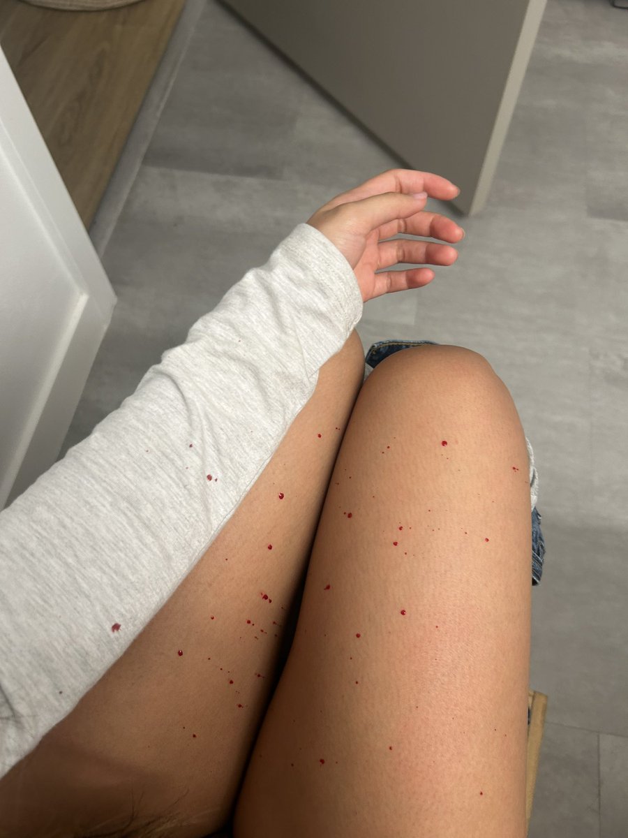 scrawniest tweet media