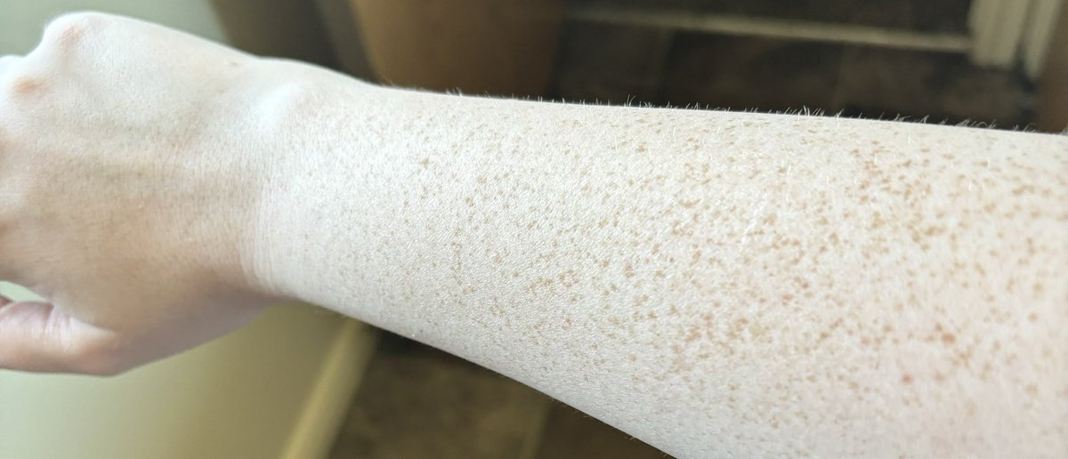 summer🇻🇪 tweet media