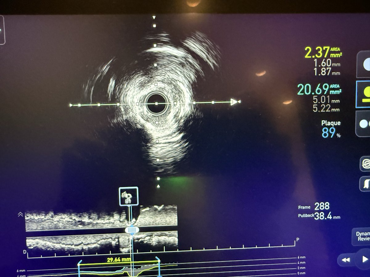 Tom Wilson tweet media