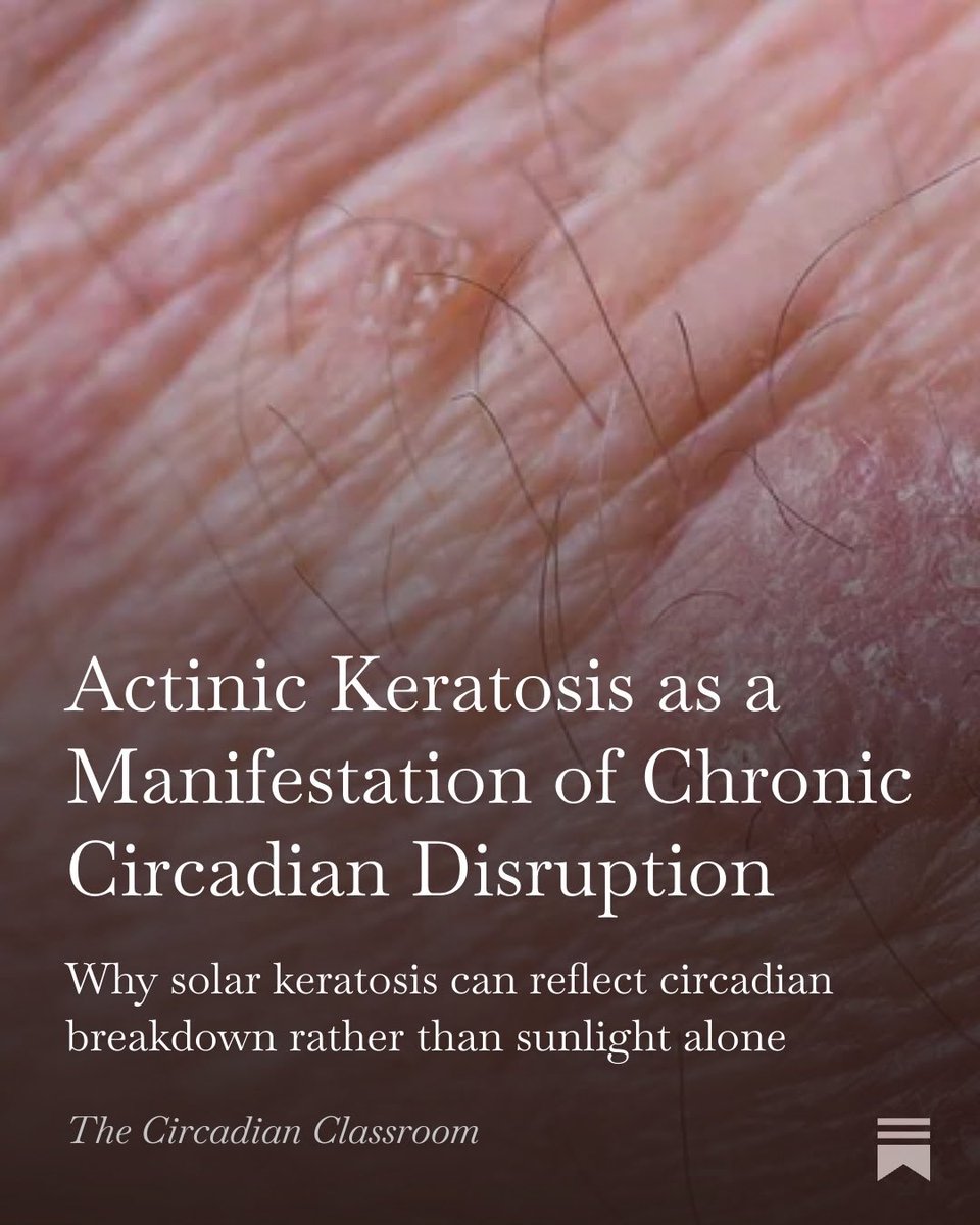 A fantastic deep dive

Actinic keratosis takes on new meaning when you filter it through the circadian lens

Full article in the post below