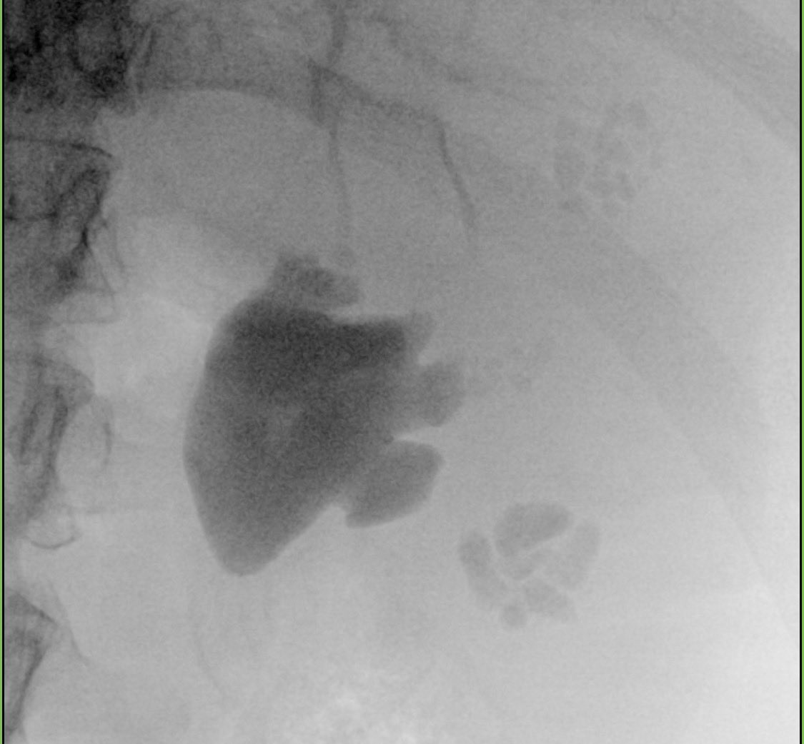 Ryan L. Steinberg MD tweet media