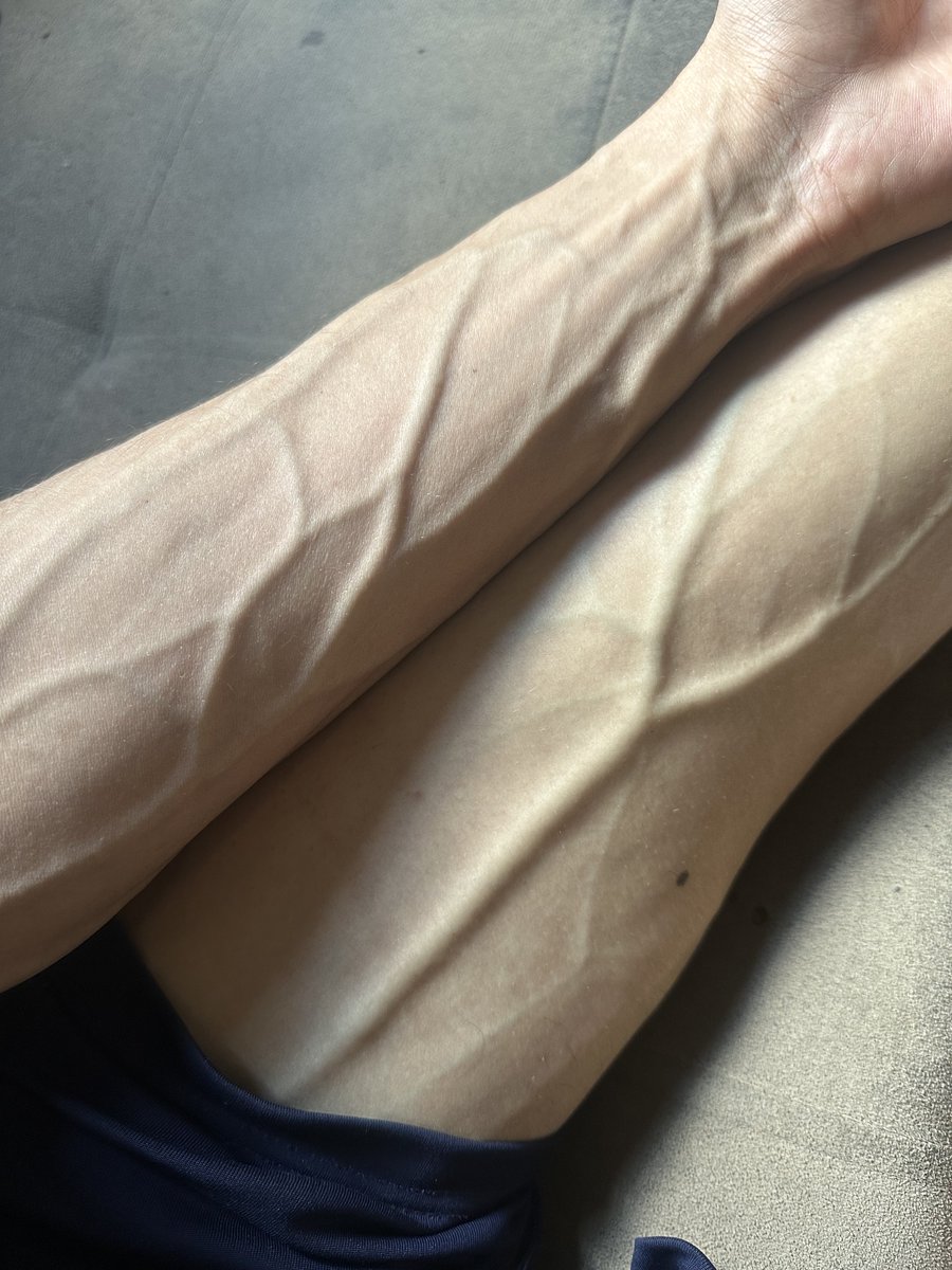 APOLO XXL🇧🇷 tweet media