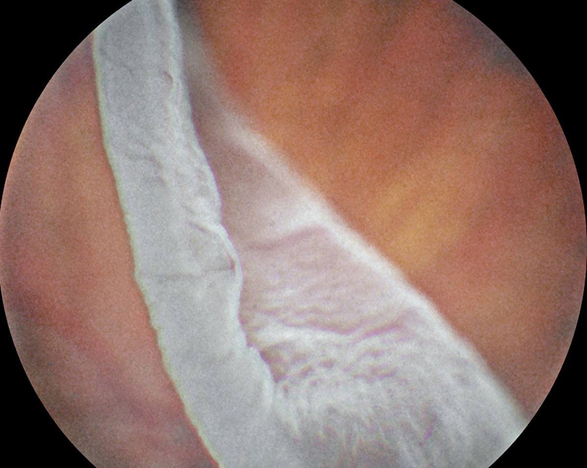 Ophthalmology Advisor tweet media