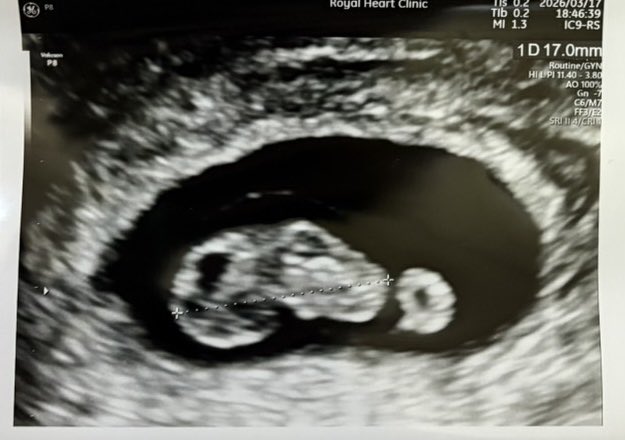 アイリス🗽 tweet media