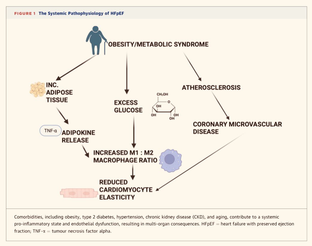santiUCI's tweet photo. Abordar la IC DIASTÓLICA en críticos ha madurado desde un modelo de disfunción simple hasta todo un SÍNDROME INFLAMATORIO complejo y sistémico, impulsado por las comorbilidades…

https://t.co/SkSbzFH7FU https://t.co/l9VM1VJF4W