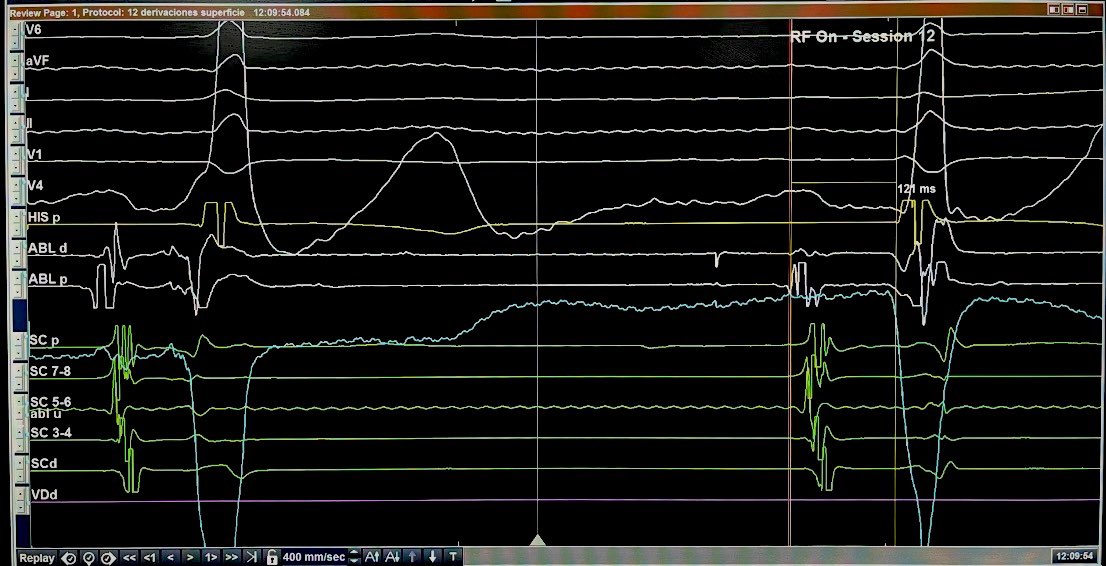 ALBERTO ALFIE tweet media