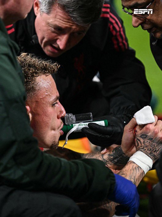 _LucaTM's tweet image. RT VE YORUM YAPALIM GÜNDEME DÜŞSÜN 

Player safety must be the priority! Noa Lang’s serious hand injury caused by unsafe advertising boards is unacceptable. @UEFA, we demand an immediate investigation and safer pitchside equipment. This cannot happen again!