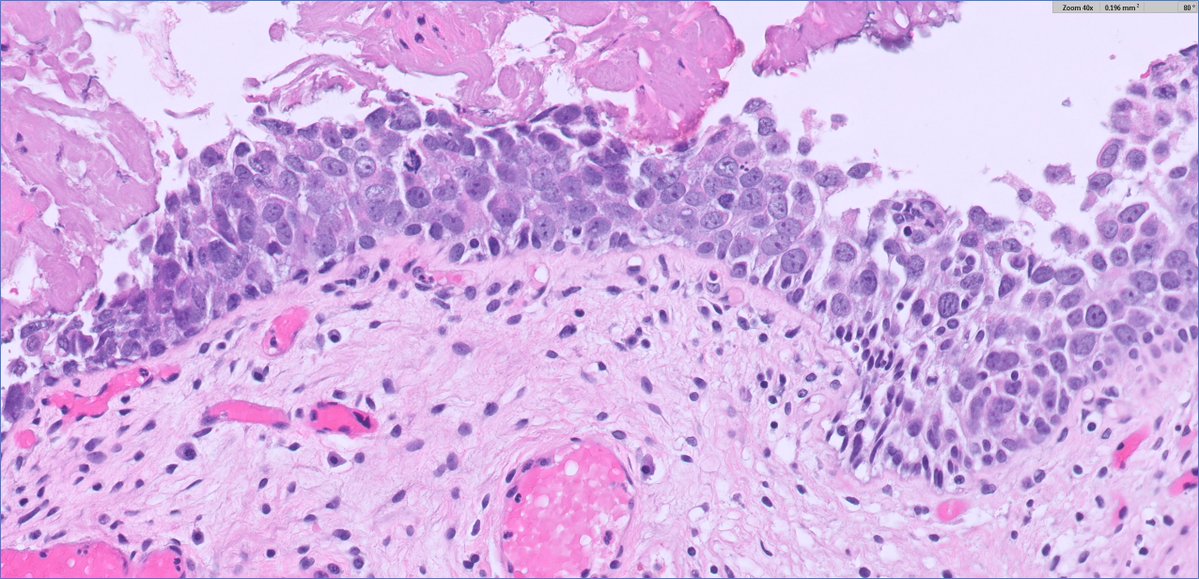 Ankur Sangoi tweet media