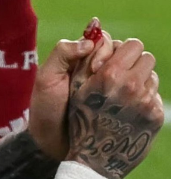 besoccer_ES's tweet photo. ❗️ Informa @yagosabuncuoglu 

A Noa Lang acaban de AMPUTARLE EL DEDO que se cortó durante el Liverpool-Galatasaray https://t.co/YSRTa22Uo8