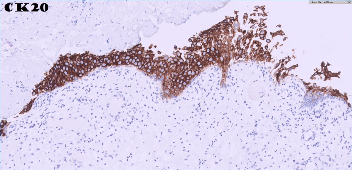 Ankur Sangoi tweet media