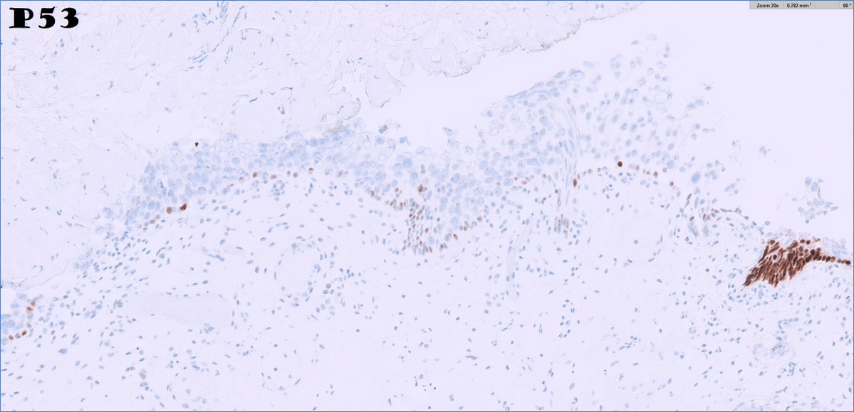 Ankur Sangoi tweet media