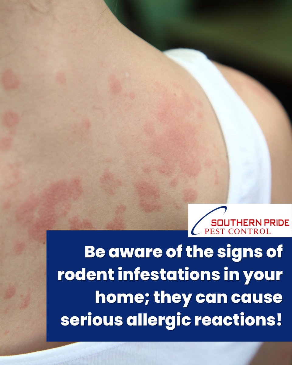 sppestcontrol's tweet photo. Did you know rodents can cause more than property damage? Their allergens can spread through your home’s air system, leading to sneezing, respiratory irritation, and allergic reactions. Protect your family’s health.

Call (256) 661-9200
https://t.co/gxNH8mLnNG https://t.co/7kTXkoOEvN