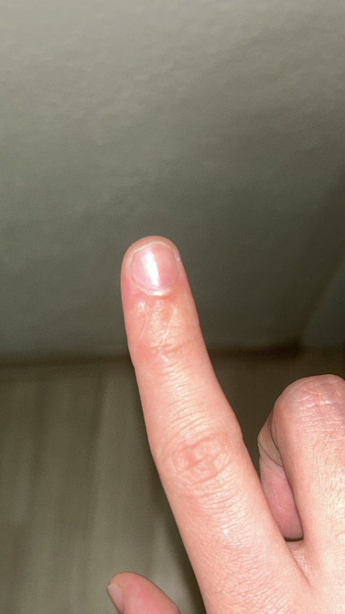 ali wincheste͙r 🍊 tweet media