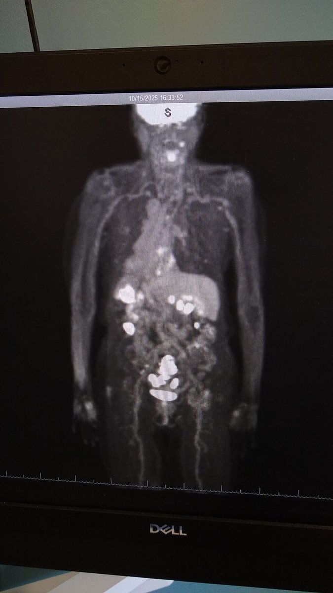 Liz "Pureblood" Smith tweet media