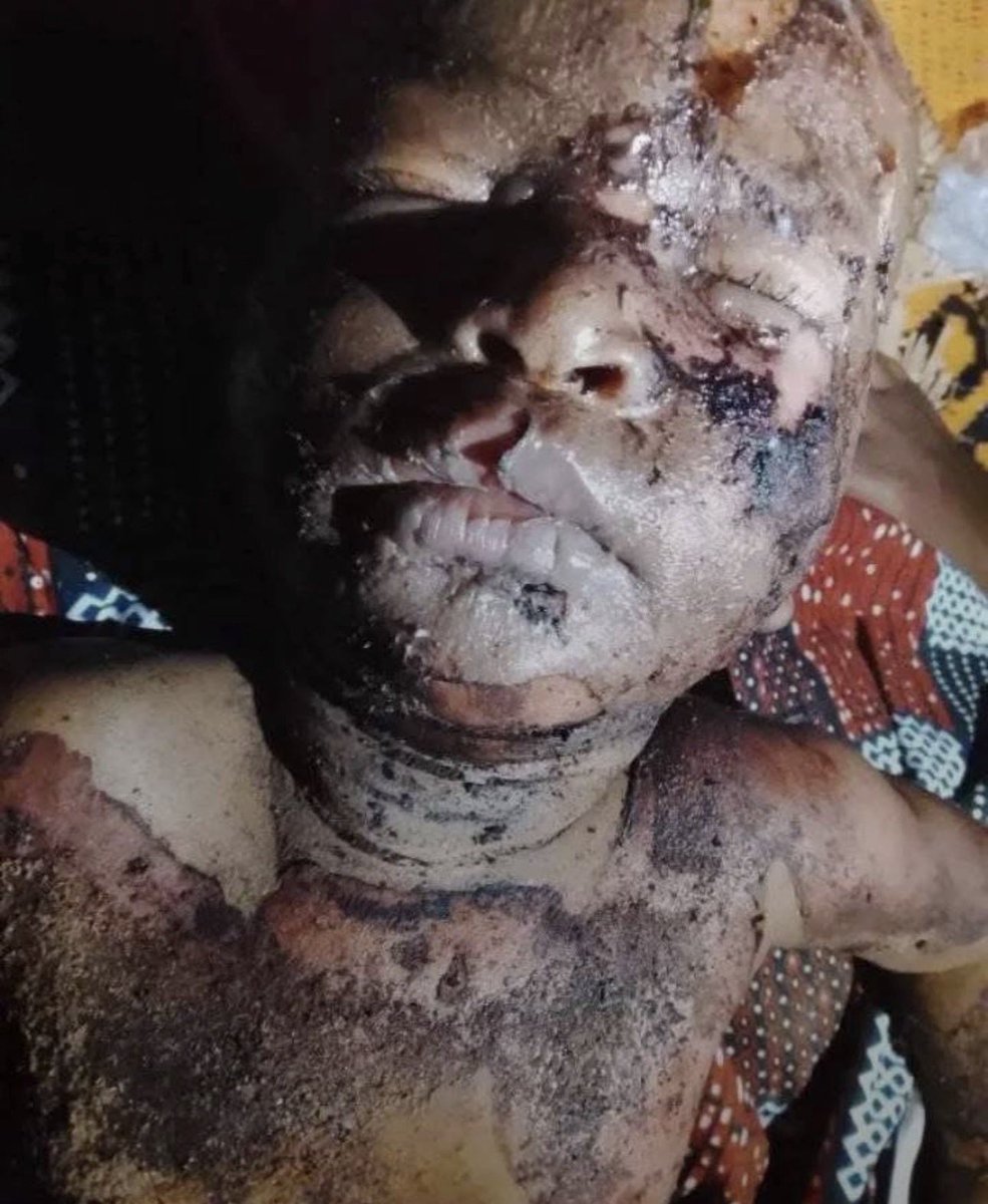 Abu Oumar👳🏿‍♂️ tweet media