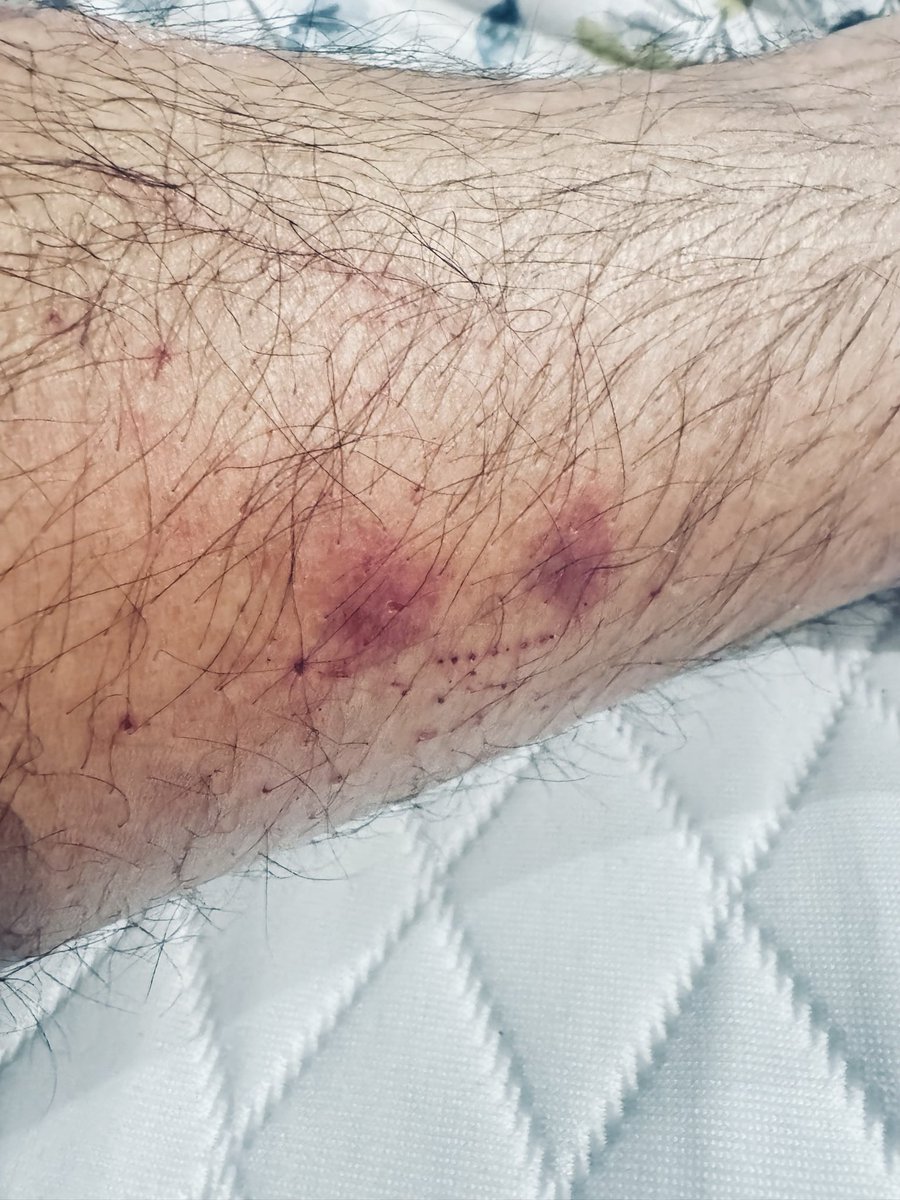 Muhammed Ashad Zalal tweet media