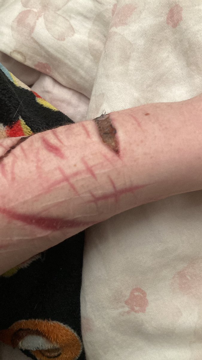 Kirishima of shedtwt tweet media