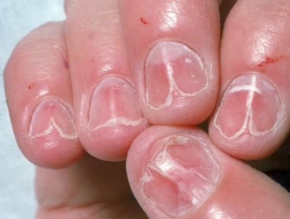 CardiovascularCorner tweet media