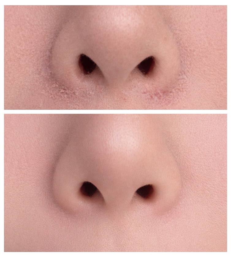 ぽにちゃ tweet media