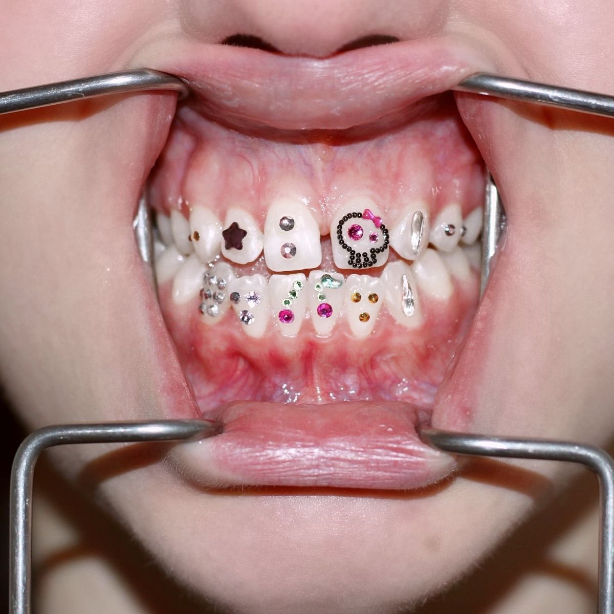 🦷 lennie 𐂯 5/13 ! tweet media