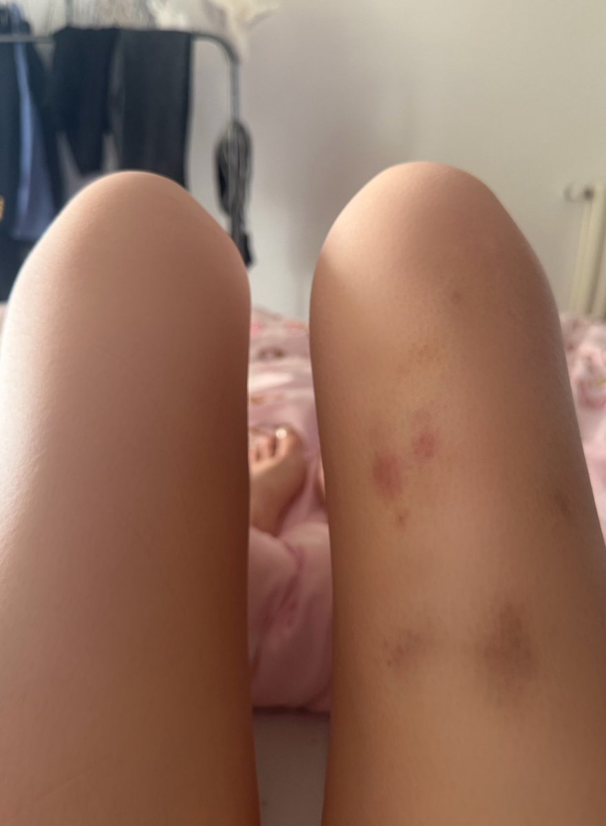 早点睡 tweet media