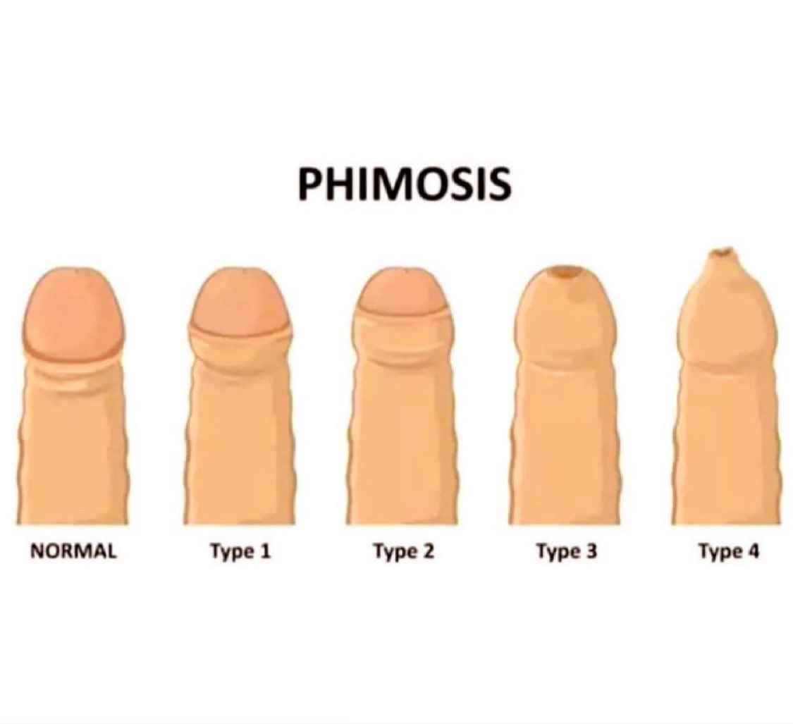 Dr Honey choudhary 🩺 tweet media