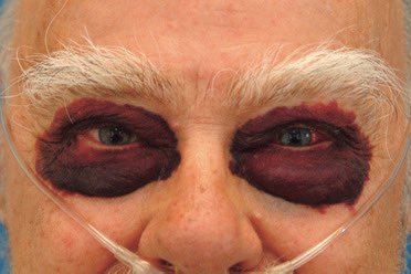 CardiovascularCorner tweet media