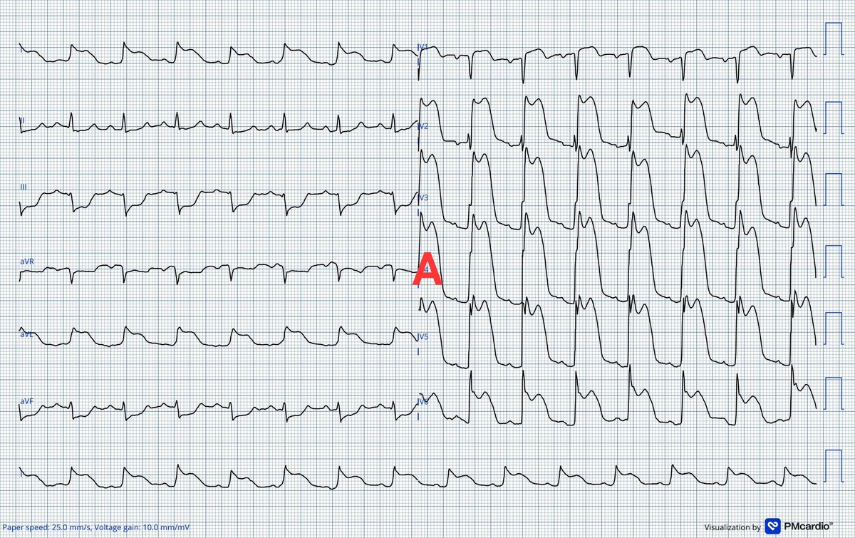 Dr J NELSON OKEMA, MD 🇬🇧 tweet media