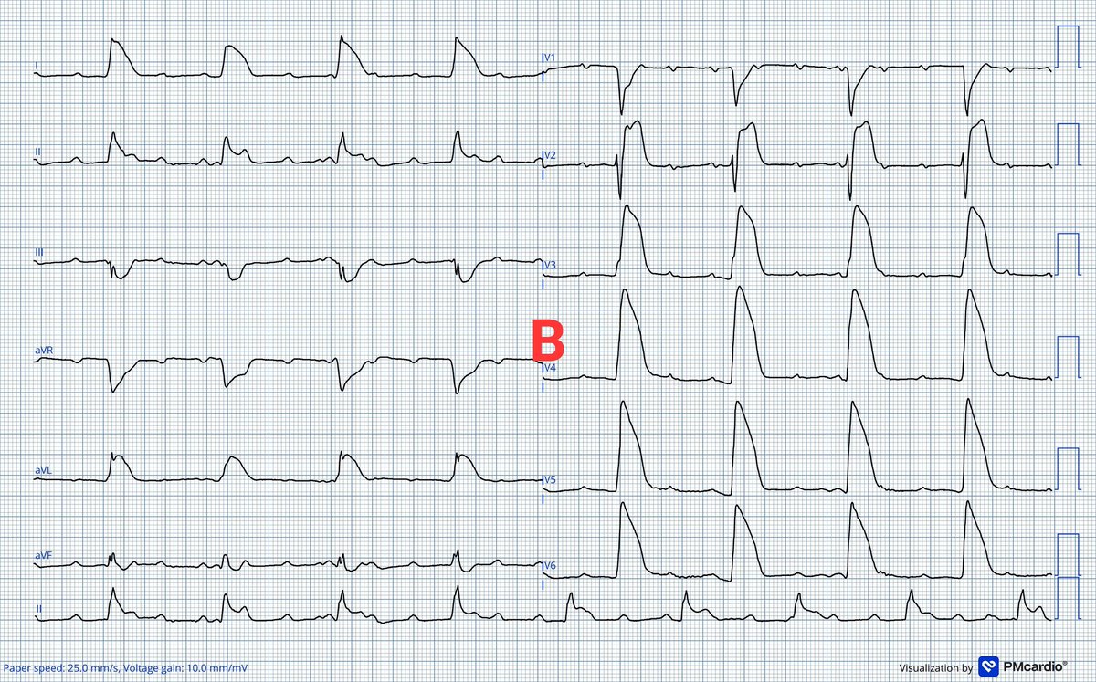 Dr J NELSON OKEMA, MD 🇬🇧 tweet media